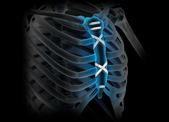 Cardiothoracic Surgery logo